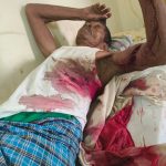 Gomia: 70-year-old man seriously injured in bear attack