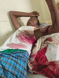 Gomia: 70-year-old man seriously injured in bear attack