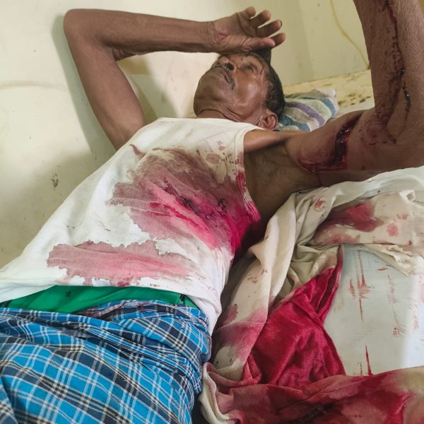 Gomia: 70-year-old man seriously injured in bear attack