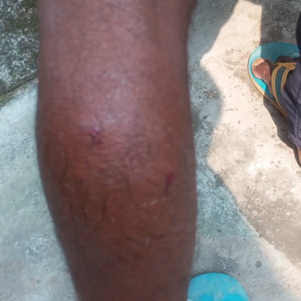 Gomia: Youth injured in jackal attack; panic among villagers.