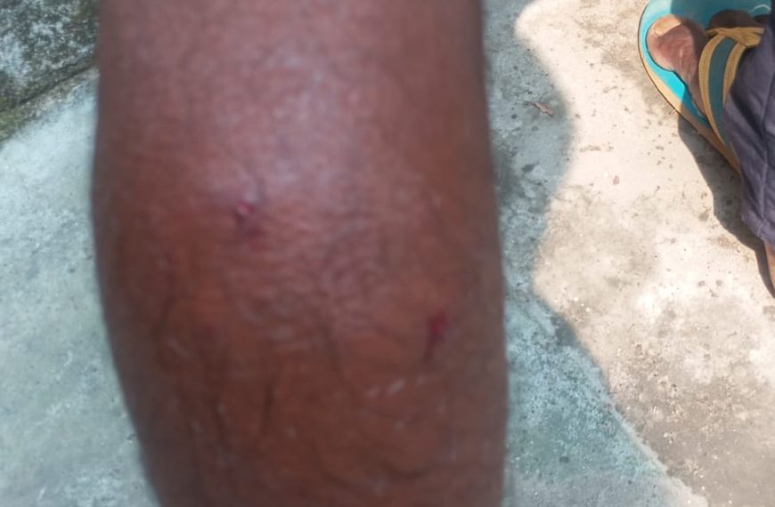 Gomia: Youth injured in jackal attack; panic among villagers.